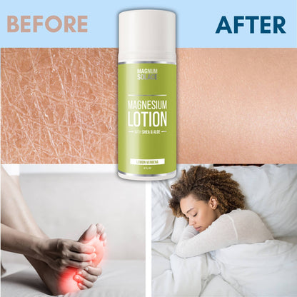 Magnesium Lotion with Aloe, Shea and Coconut (Lemon Verbena)